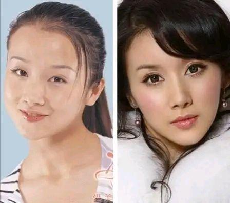 明星 整形,美丽背后的秘密与争议
